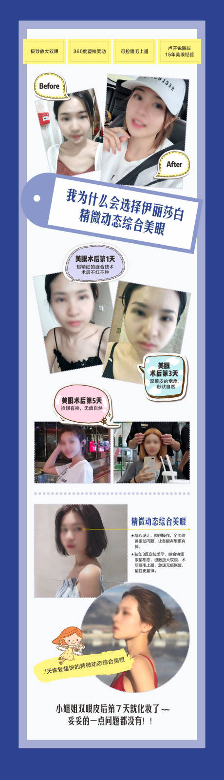 源文件下载【医美双眼皮长图】编号：86090018710353882