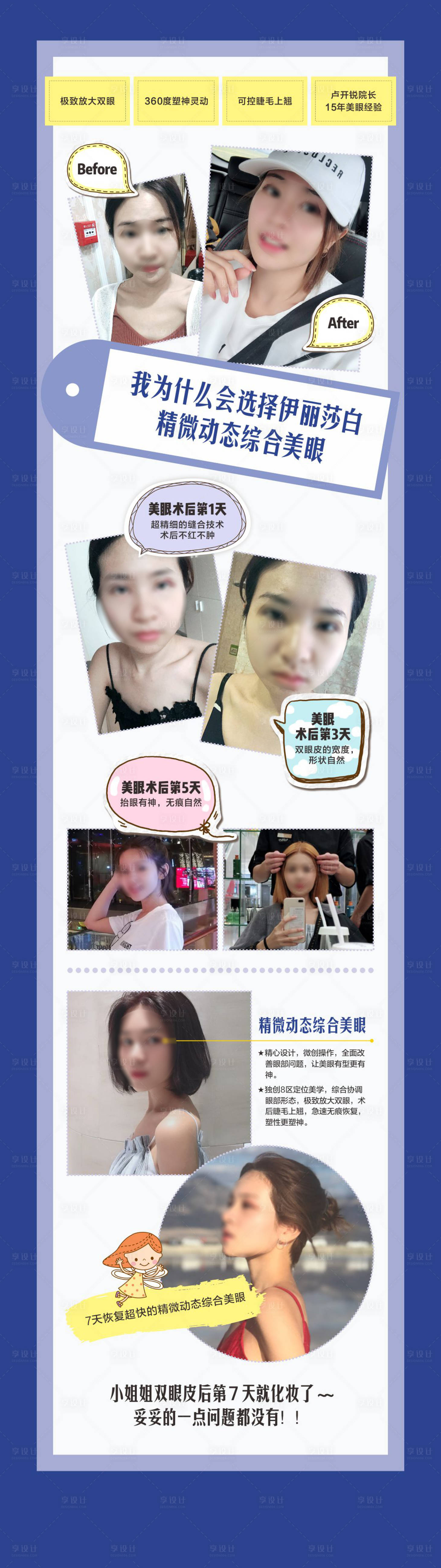 源文件下载【享设计】搜索编号：86090018710353882【医美双眼皮长图】