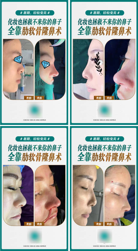 源文件下载【隆鼻案例海报】编号：60570018674043908