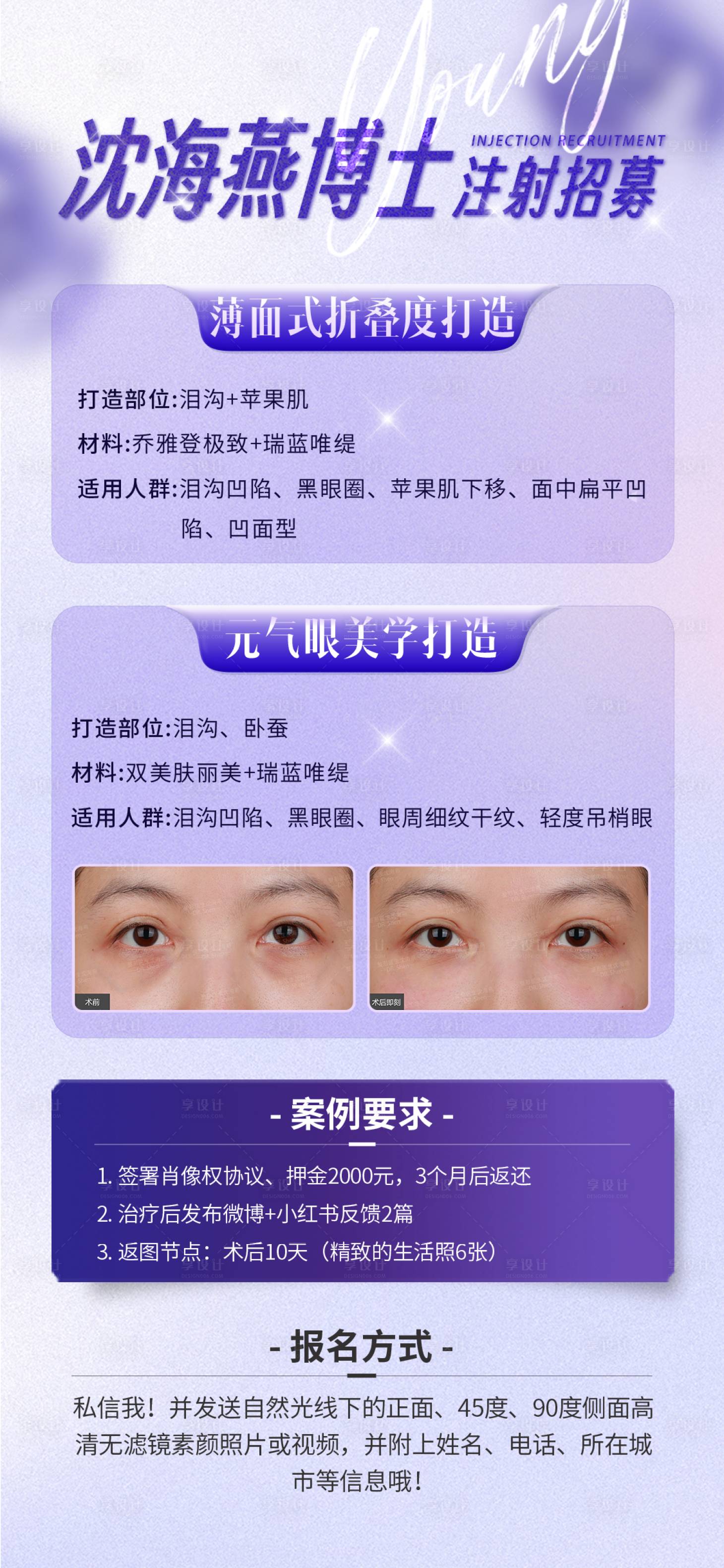 源文件下载【医美招募海报】编号：48240019052527826