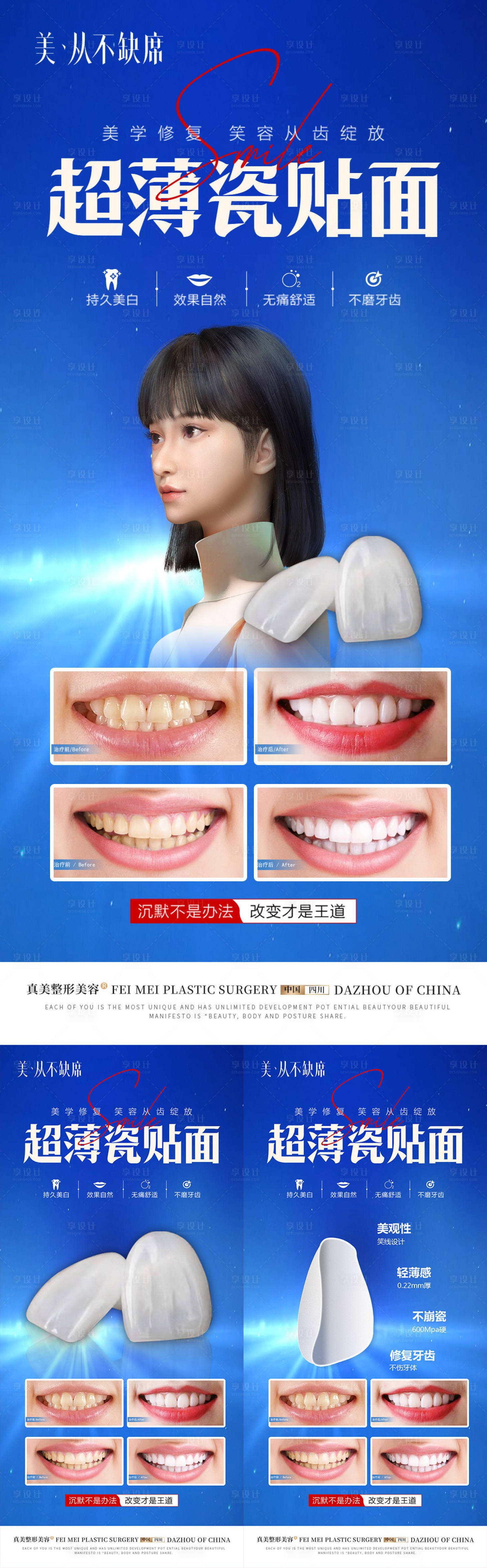 源文件下載【享設計】搜索編號：45150018994759764【口腔瓷貼面活動案例海報】