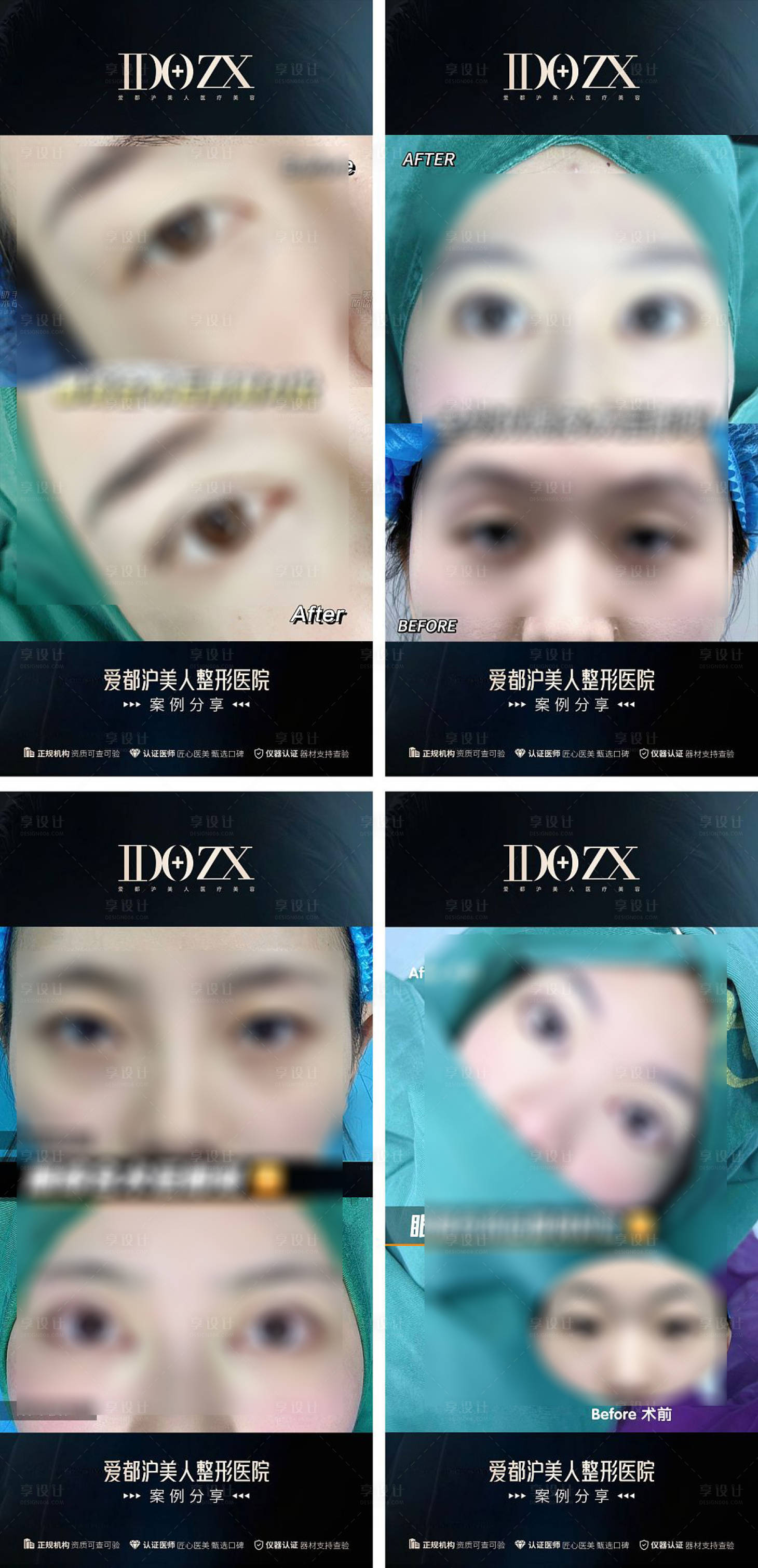 源文件下載【享設計】搜索編號：51190018856126917【醫美雙眼皮案例集】