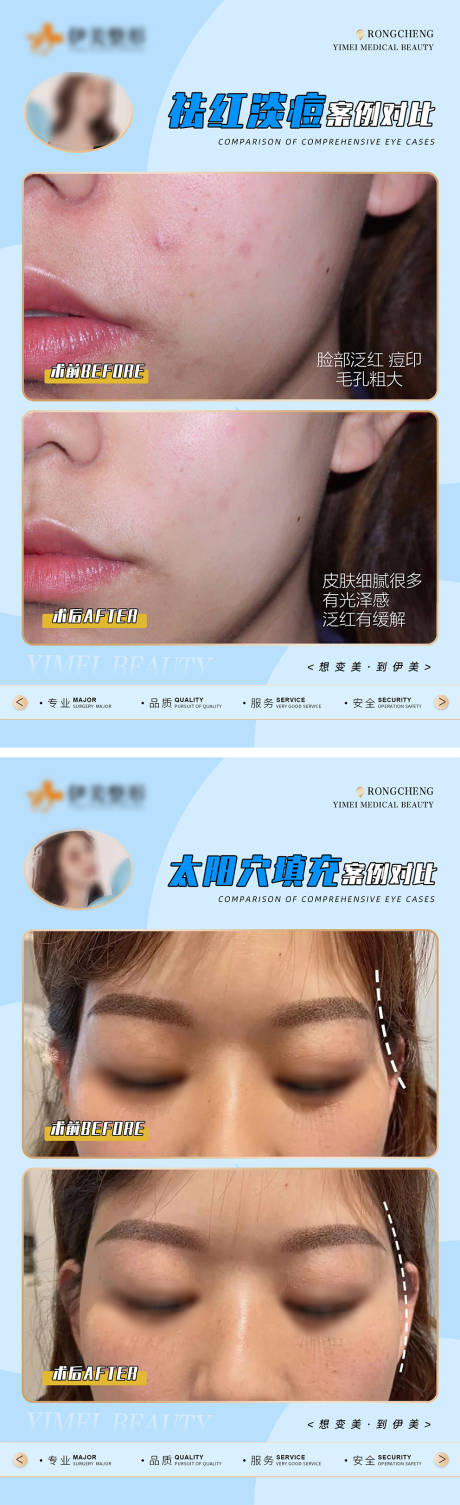 源文件下载【医美案例对比模版海报】编号：62480018485634364