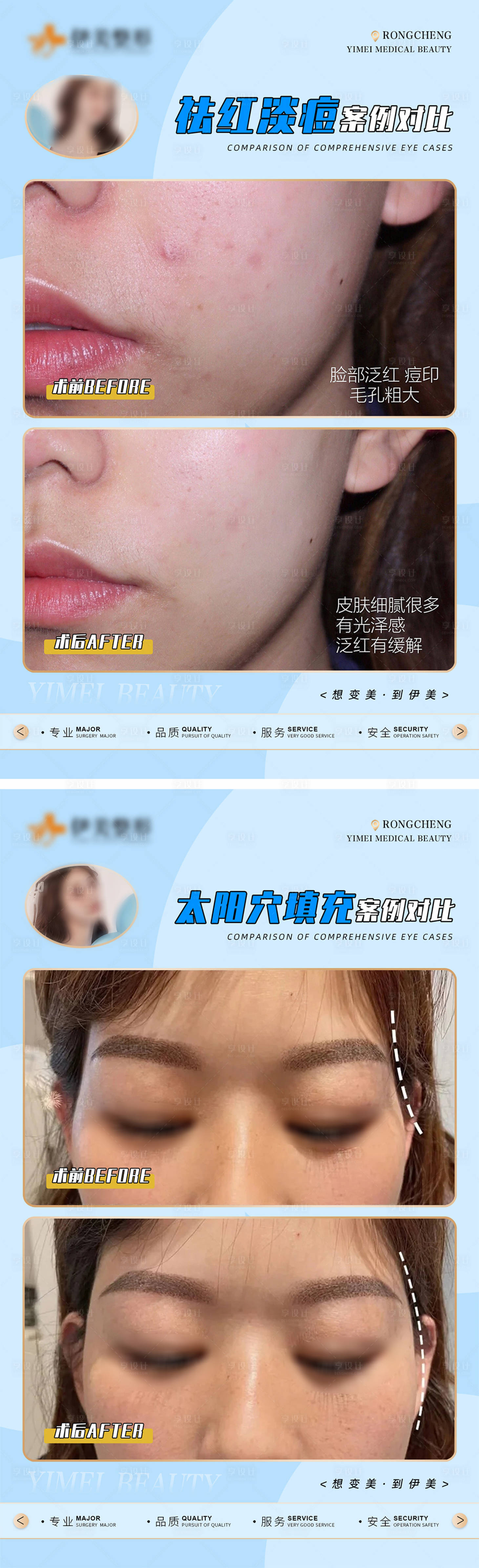 源文件下载【医美案例对比模版海报】编号：62480018485634364