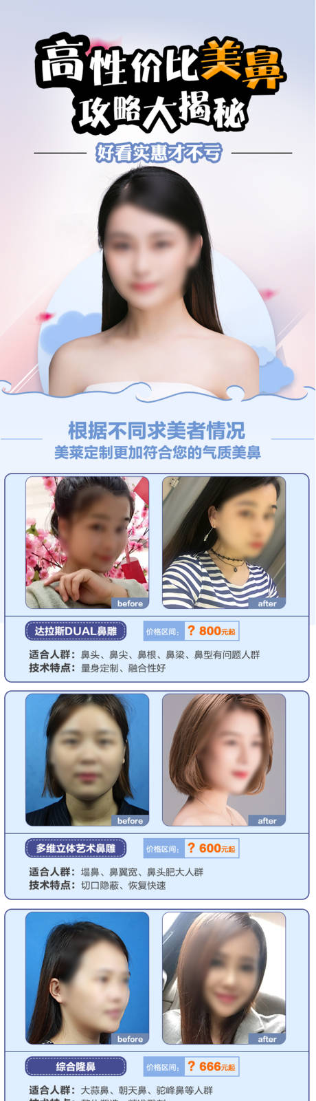 源文件下载【医美隆鼻价格详情页】编号：95560018936274677