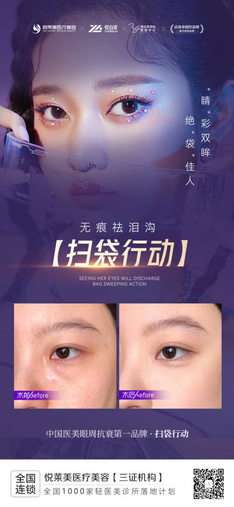 源文件下载【祛眼袋案例】编号：33500019022202597