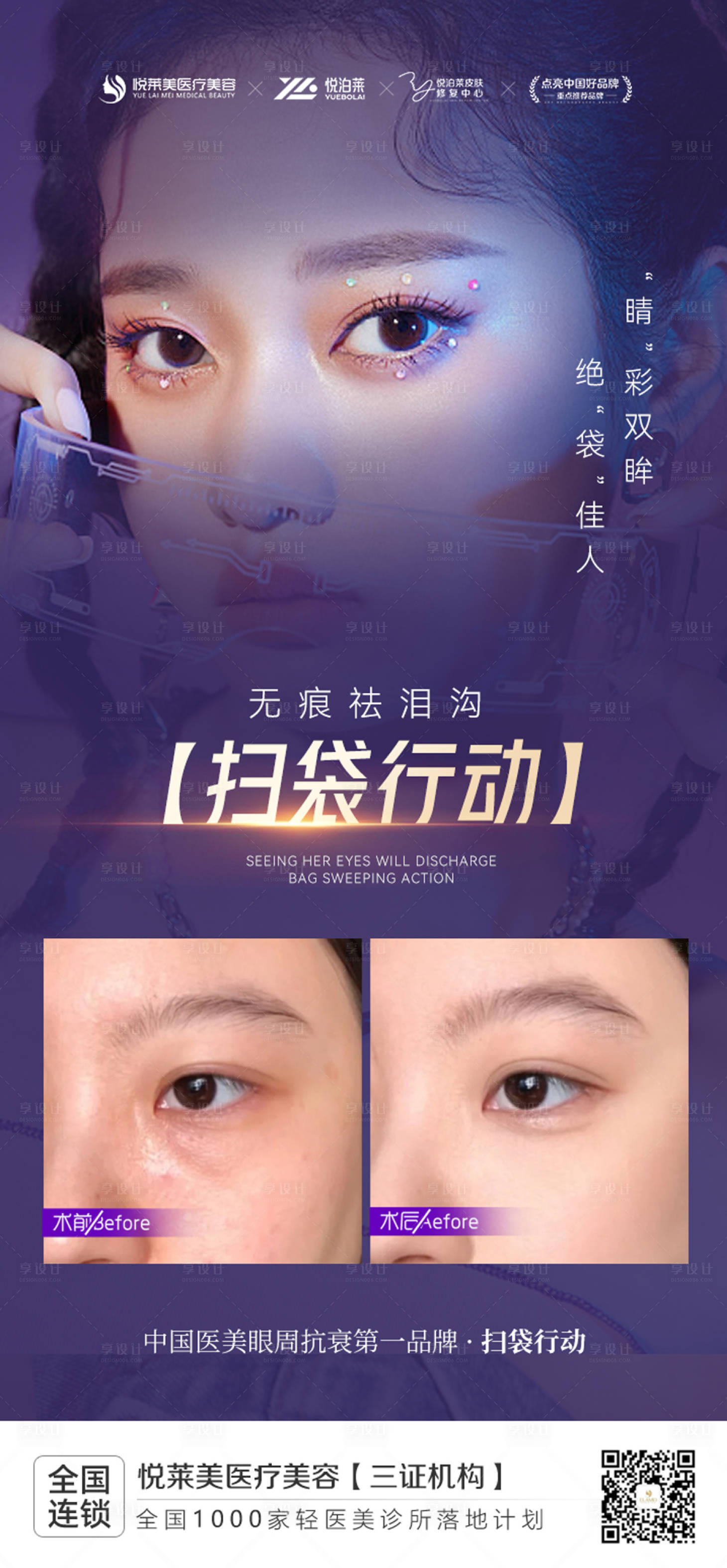 源文件下載【祛眼袋案例】編號：33500019022202597