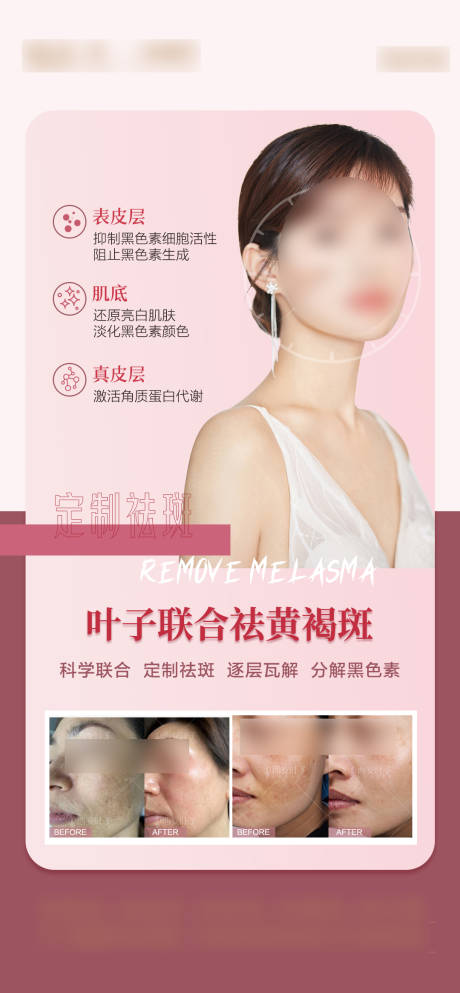 源文件下载【医美案例海报】编号：33720018472496857