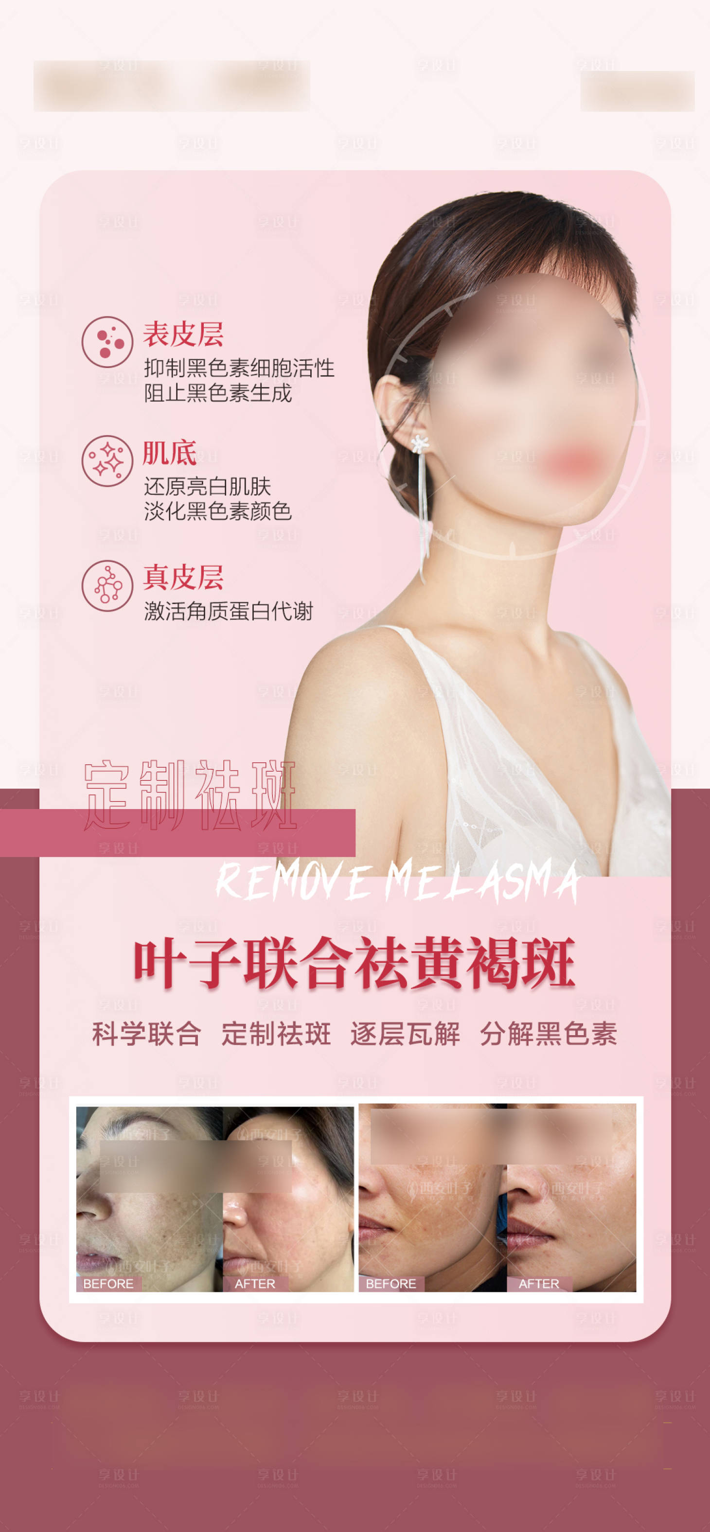 源文件下載【醫(yī)美案例海報】編號：33720018472496857
