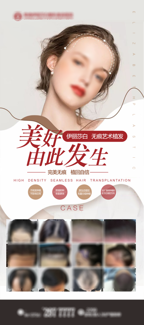 源文件下载【医美植发展架】编号：65950018973106040