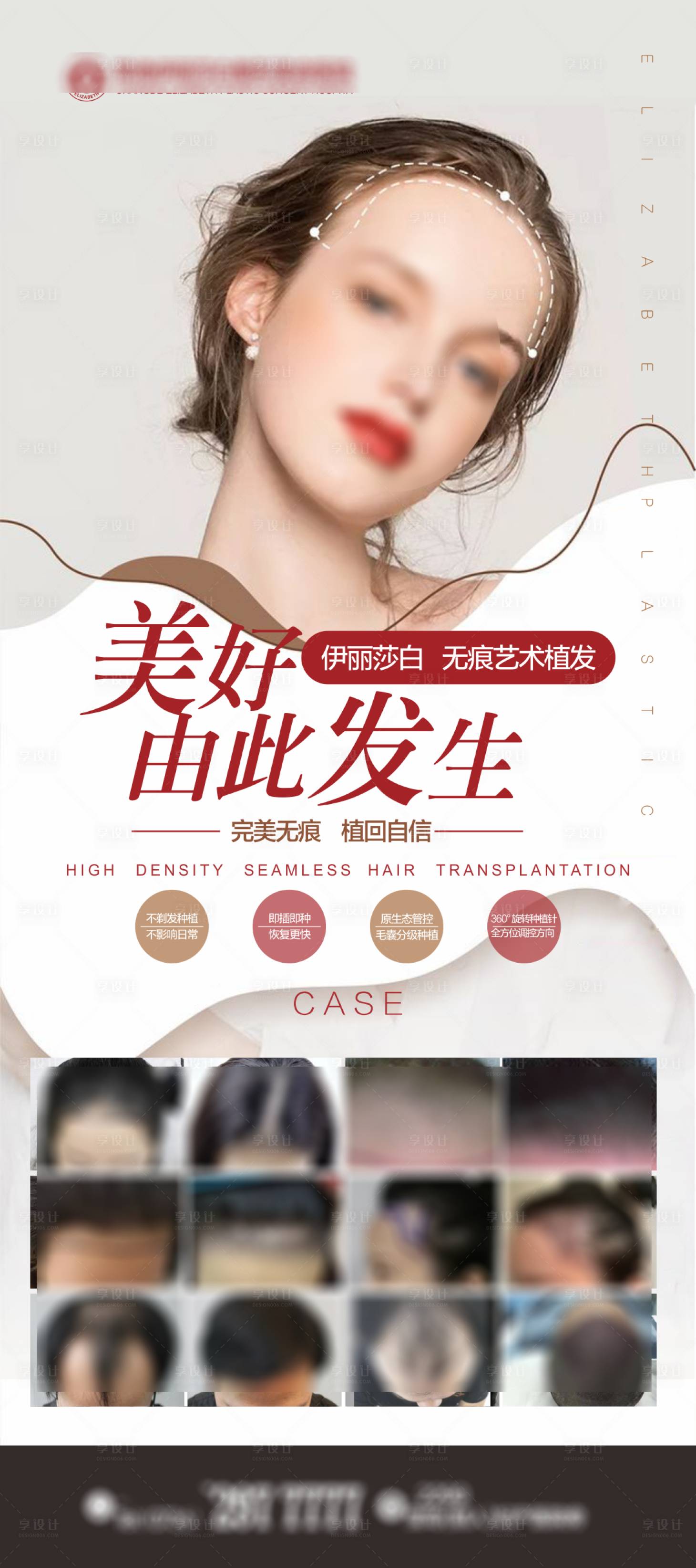 源文件下载【医美植发展架】编号：65950018973106040