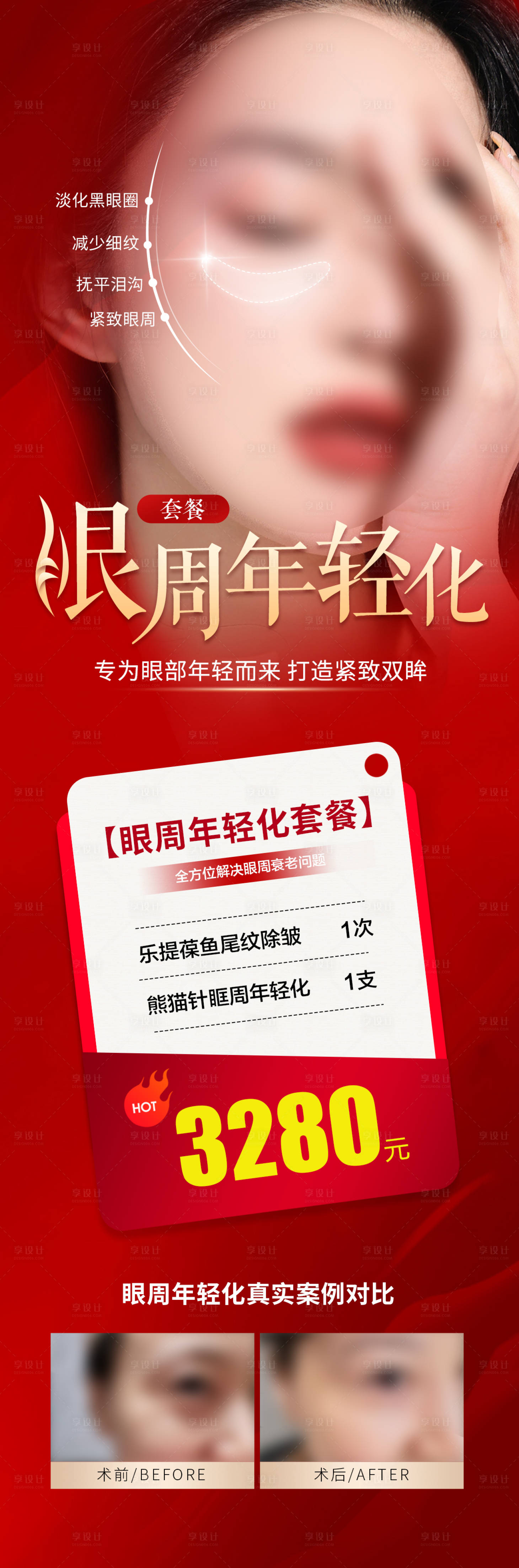 源文件下載【享設計】搜索編號：59820019025357044【眼周年輕化套餐價格海報長圖】