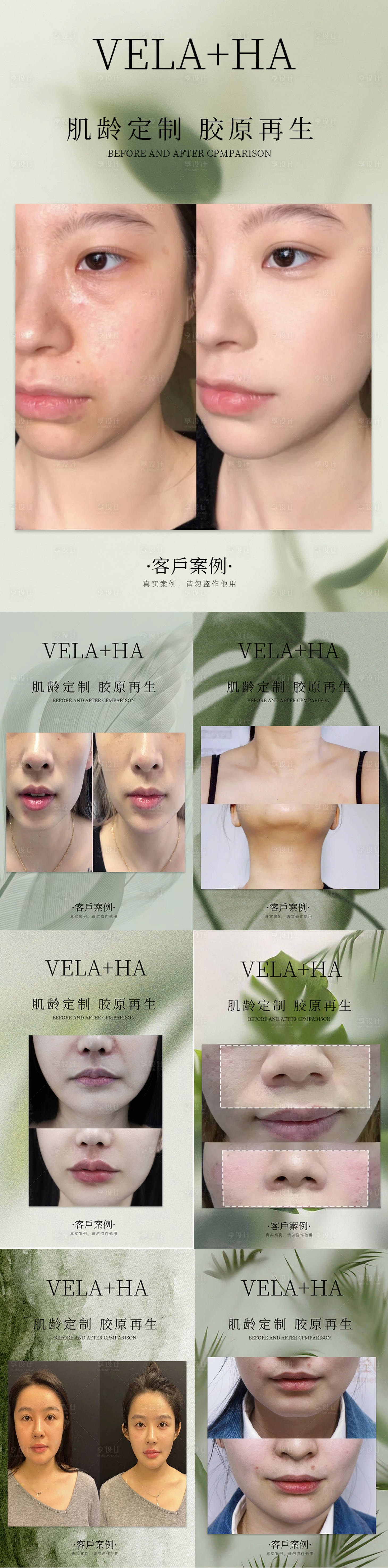源文件下载【享设计】搜索编号：94130018453918644【医美抗衰对比图】