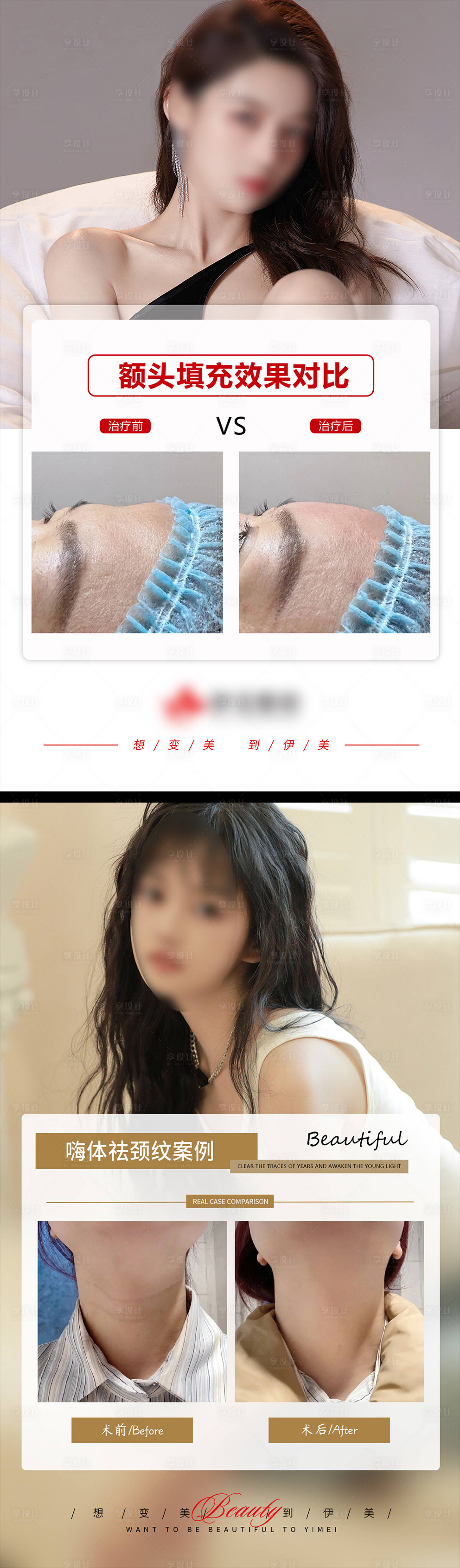 源文件下载【享设计】搜索编号：76840019046825461【填充额头祛颈纹案例】