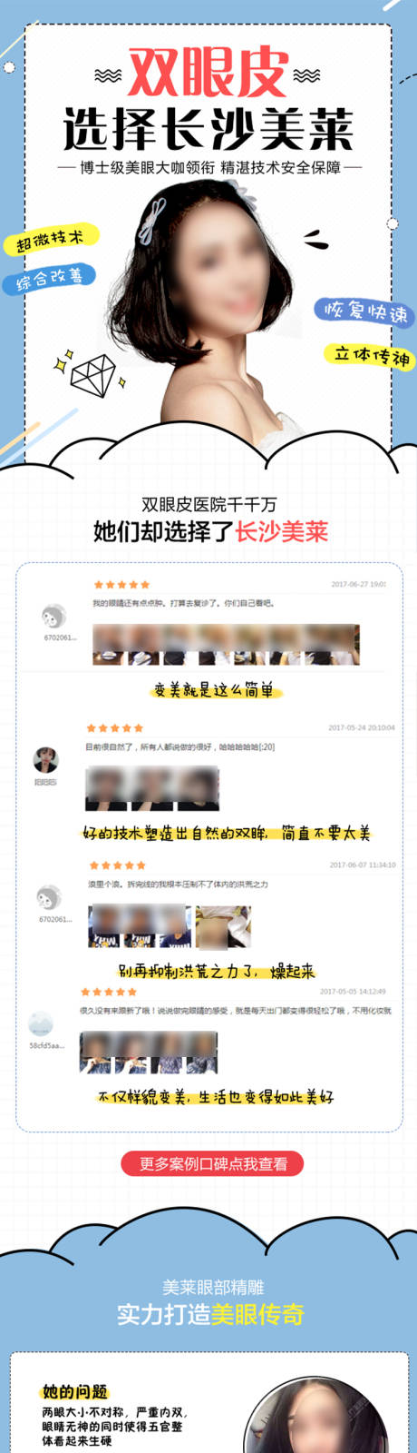源文件下载【享设计】搜索编号：48180018965351393【医美双眼皮口碑详情页】