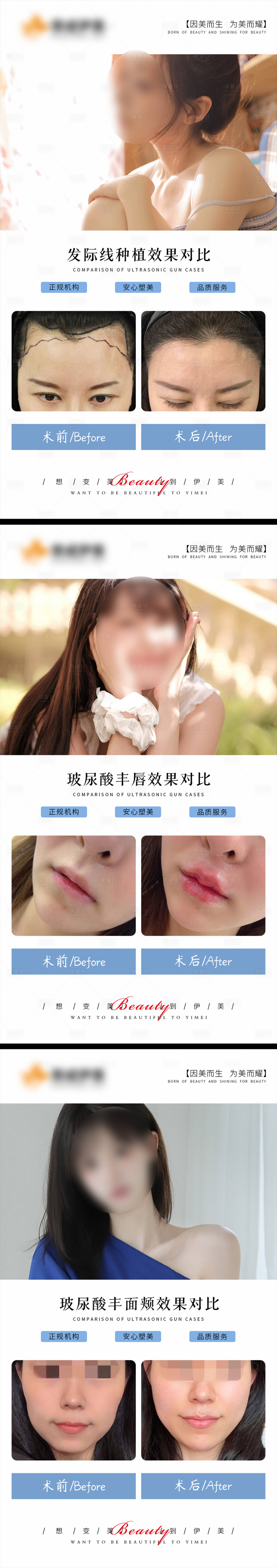 源文件下載【享設計】搜索編號：64290018977835884【醫美案例對比海報】