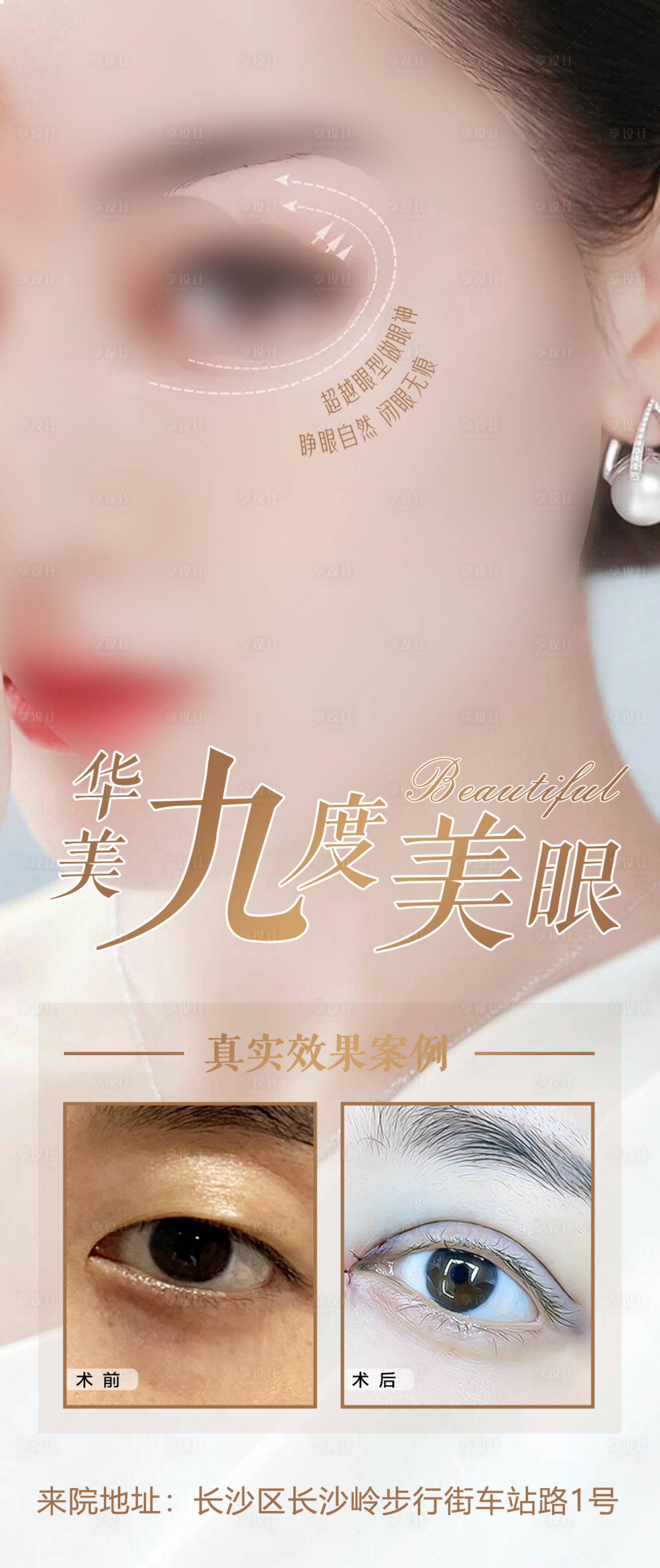 源文件下载【享设计】搜索编号：89710018821719750【华美九度美眼案例对比海报】