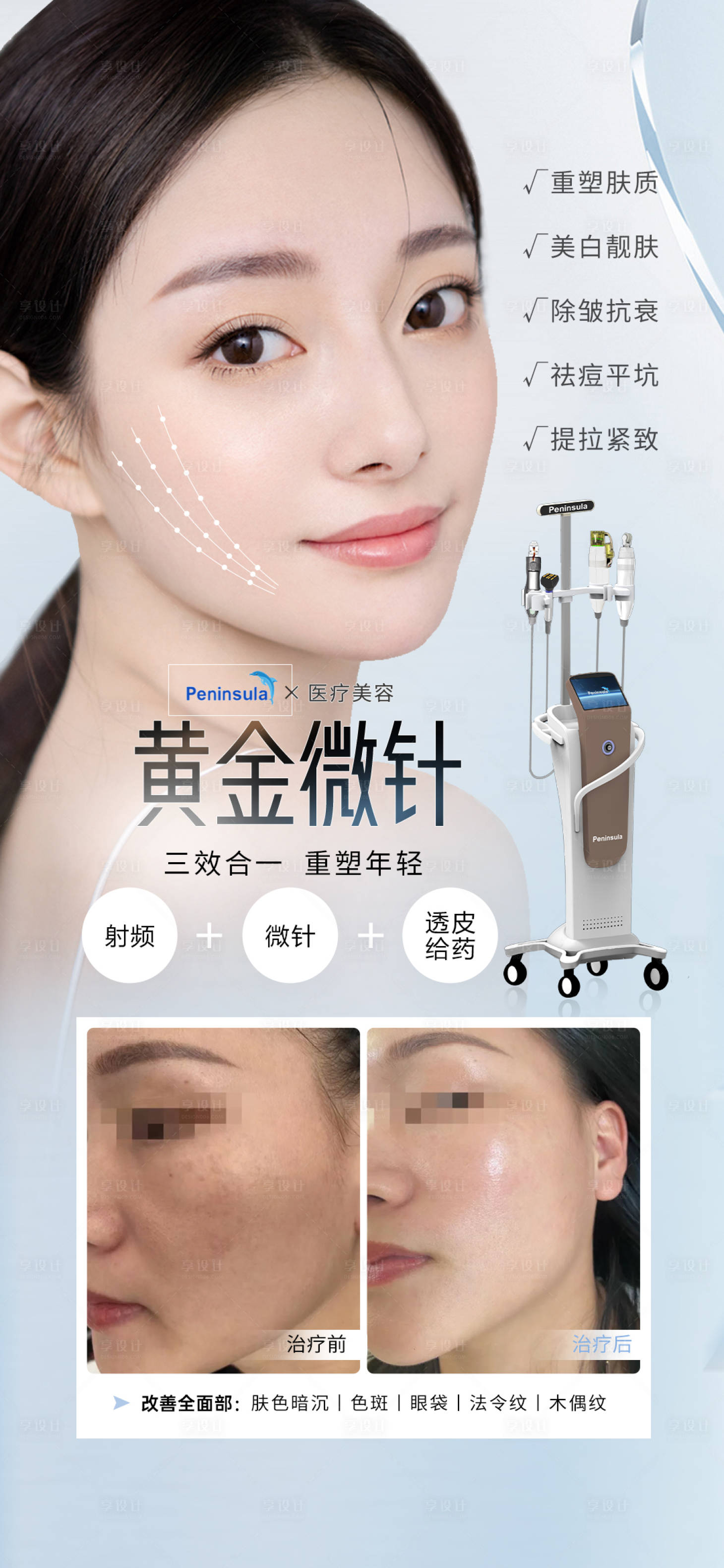 源文件下载【享设计】搜索编号：81500018651489294【医美黄金微针全面部抗衰海报】