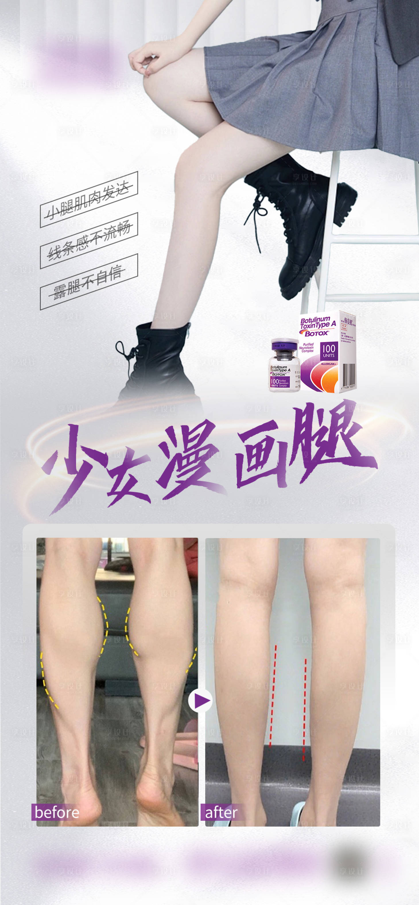 源文件下载【保妥适瘦腿案例海报】编号：83380018988712361