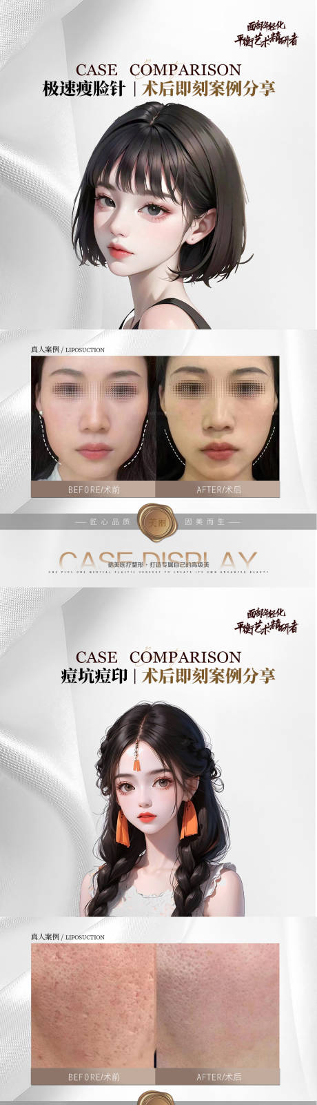 源文件下载【医美案例对比系列海报】编号：97470018907567293