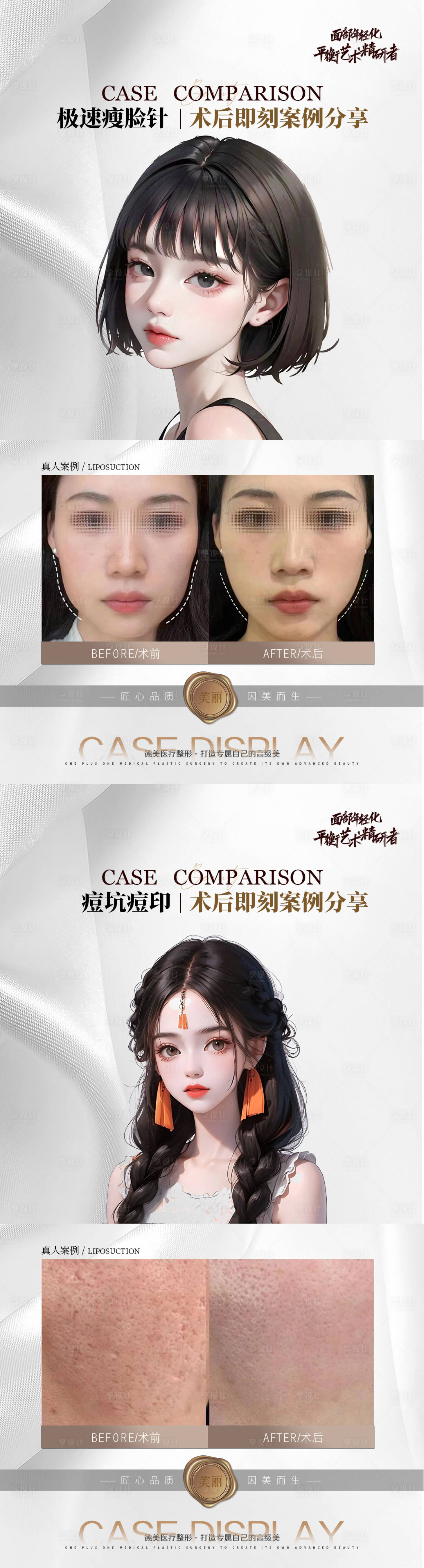 源文件下载【医美案例对比系列海报】编号：97470018907567293