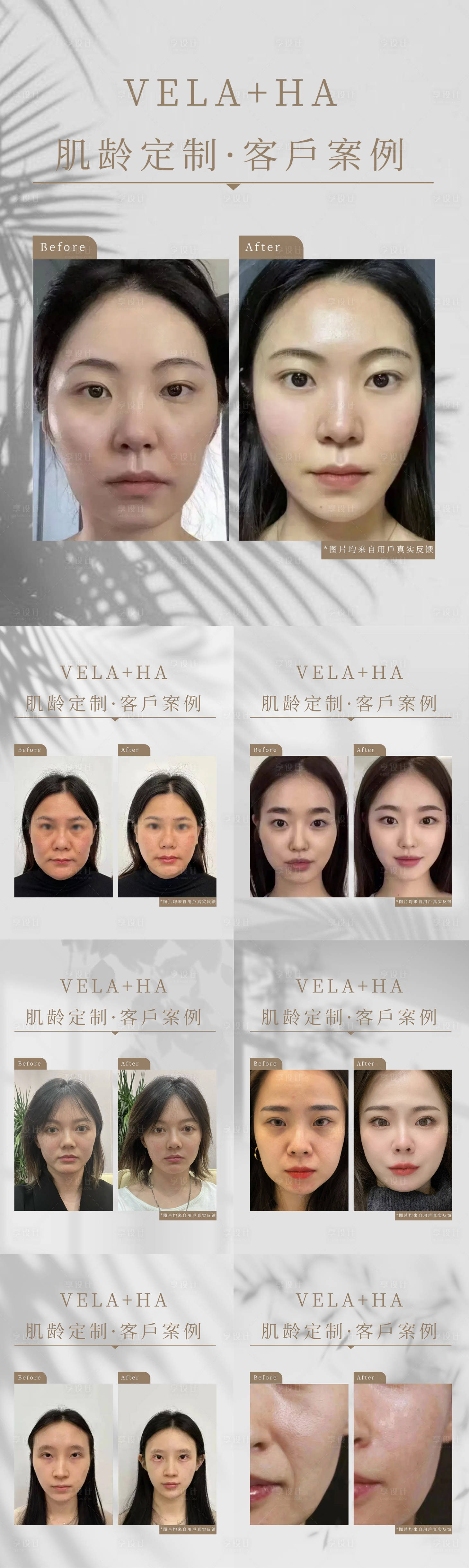 源文件下载【医美抗衰对比图】编号：79180018454001118