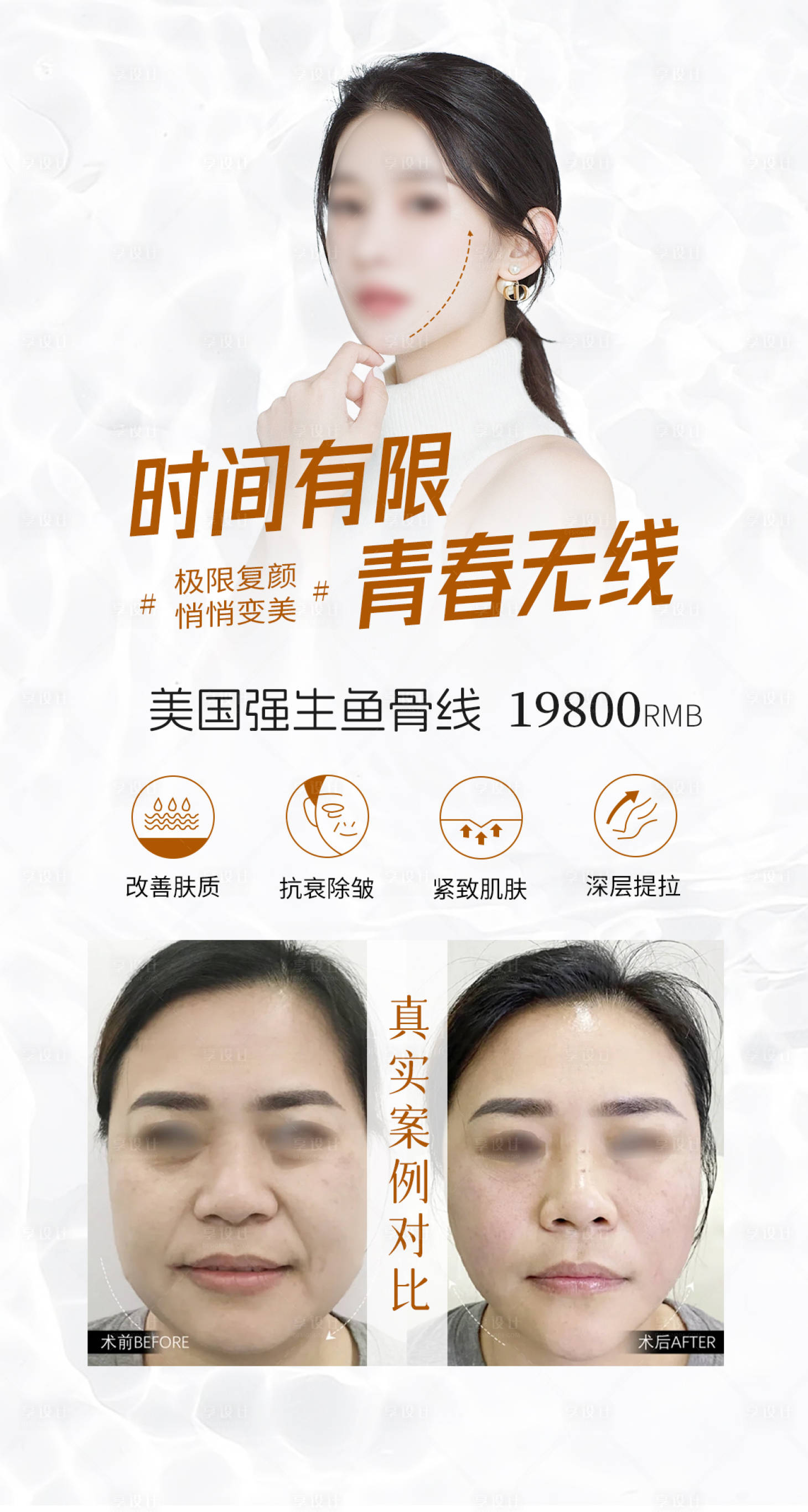 源文件下载【美国强生鱼骨线医美海报】编号：93760018544375418