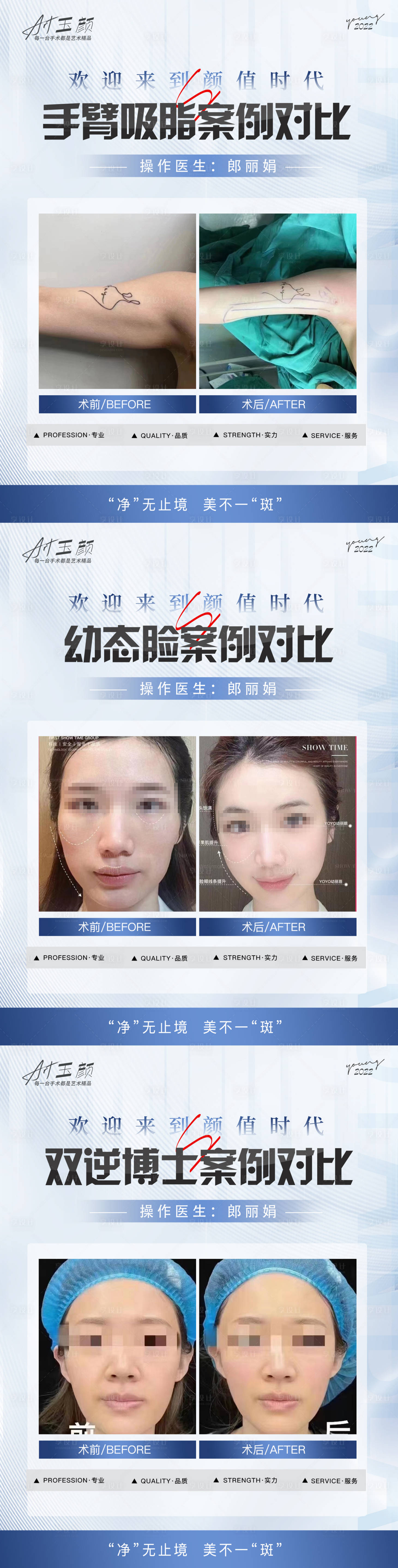源文件下載【享設計】搜索編號：33210018718311960【醫美案例對比系列海報】