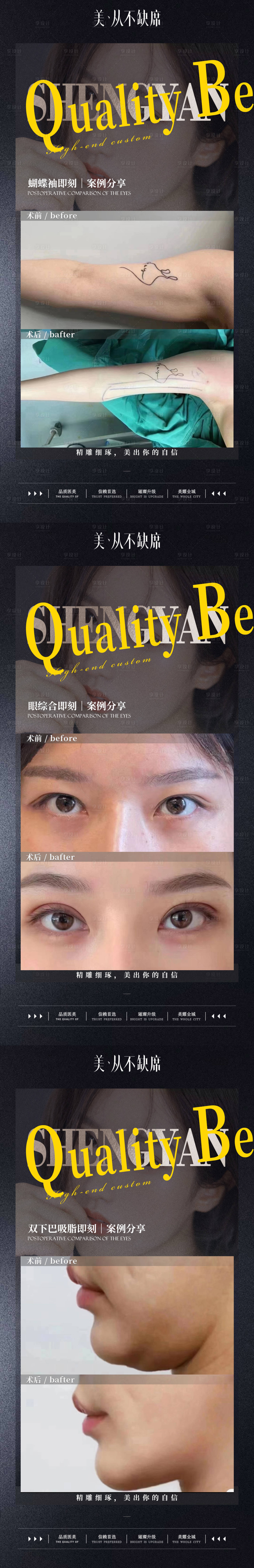 源文件下载【享设计】搜索编号：60540018992927158【整形案例海报】