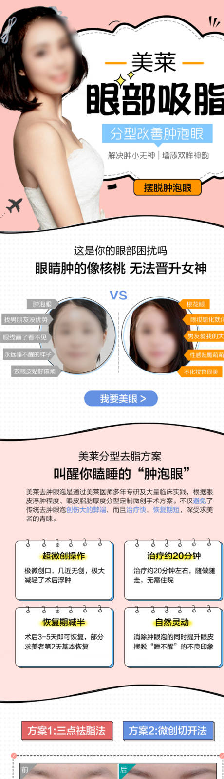 源文件下载【医美眼部吸脂详情页】编号：14170018965951942
