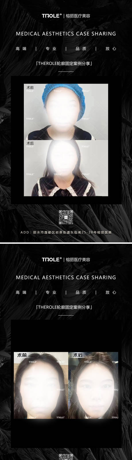 源文件下载【医美对比图案例系列海报】编号：33440018730258478
