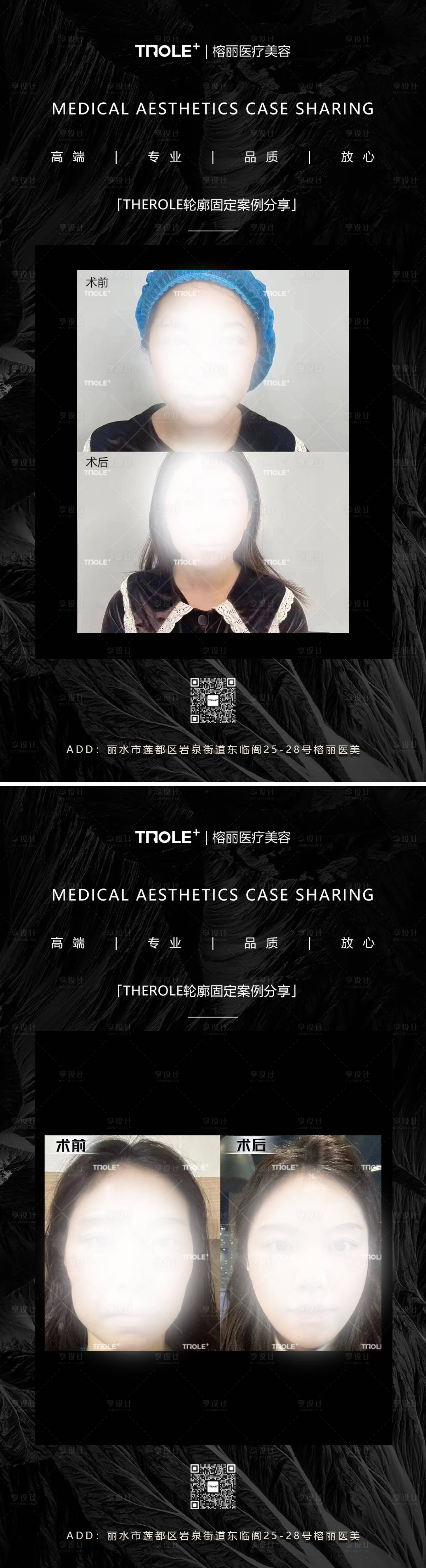 源文件下載【享設計】搜索編號：33440018730258478【醫美對比圖案例系列海報】