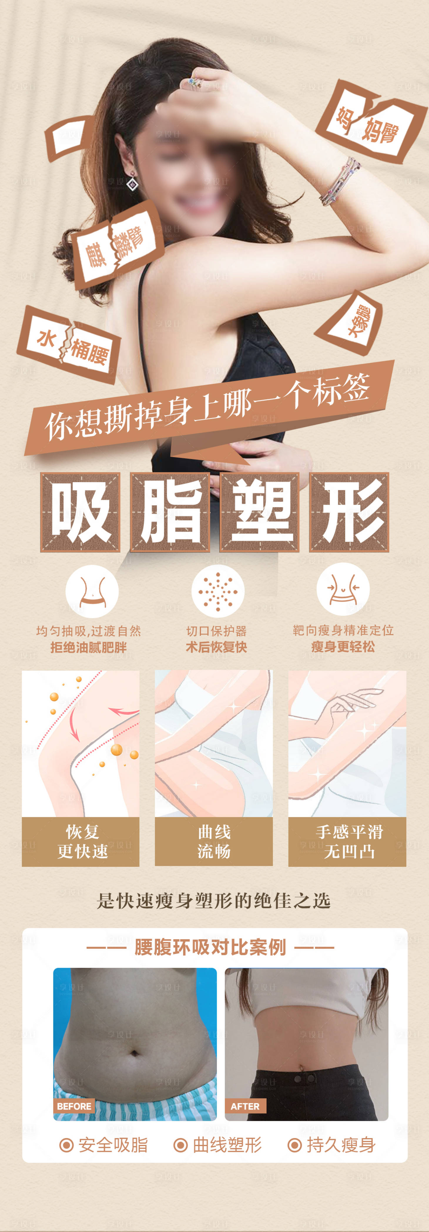 源文件下载【吸脂案例海报】编号：84410018523382504