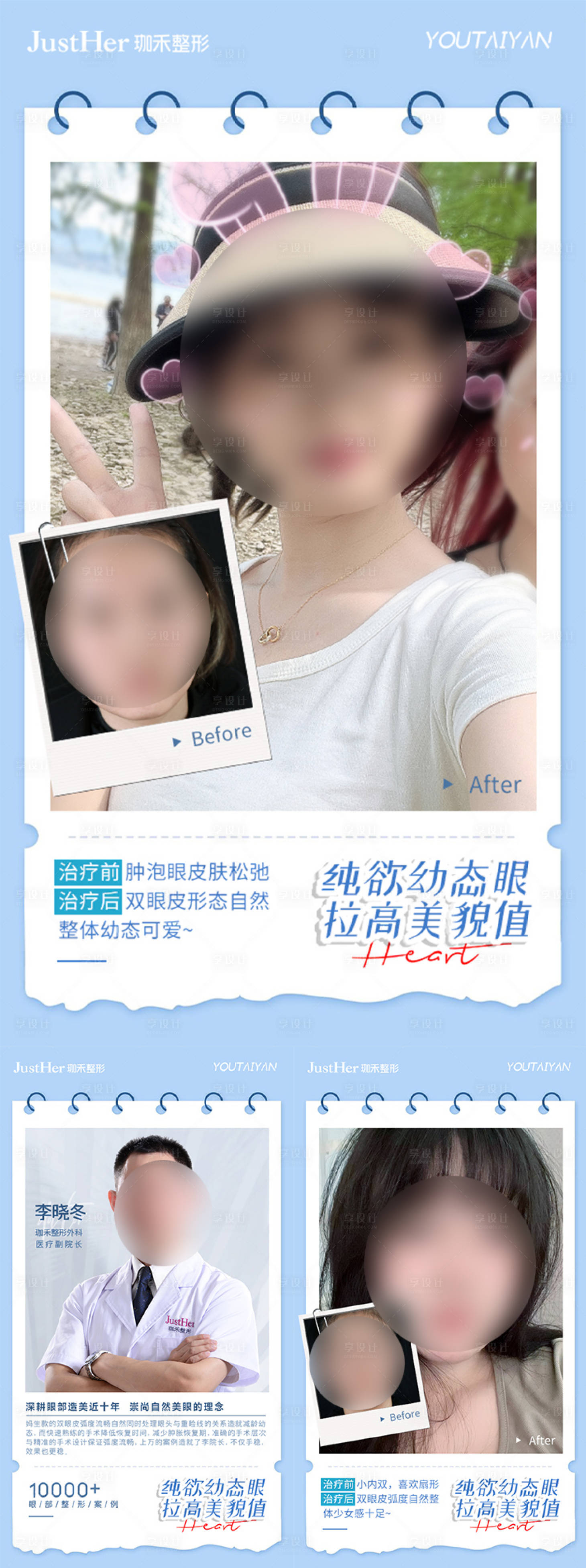 源文件下載【享設計】搜索編號：47500019050967109【雙眼皮案例對比海報】