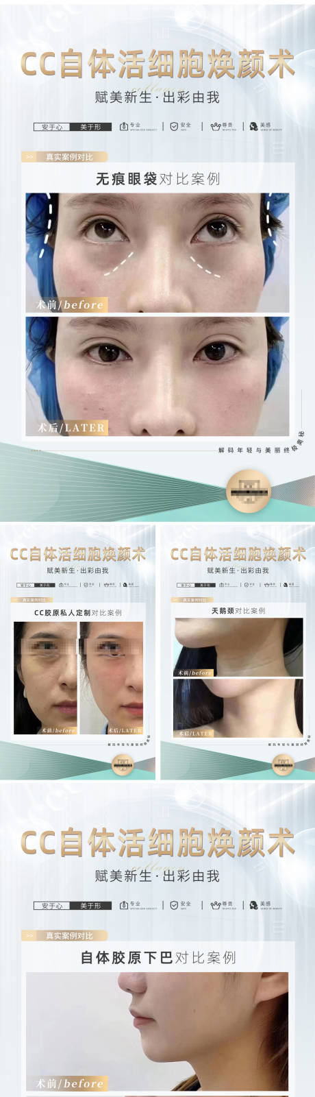 源文件下载【医美对比图】编号：17560018540195621