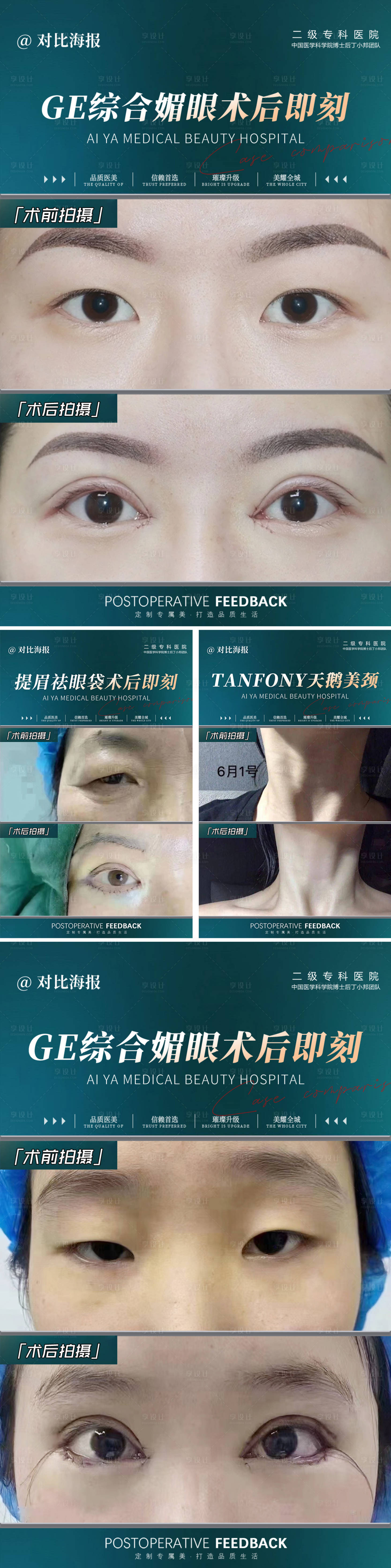 源文件下载【享设计】搜索编号：49390018555664551【医美对比图案例】