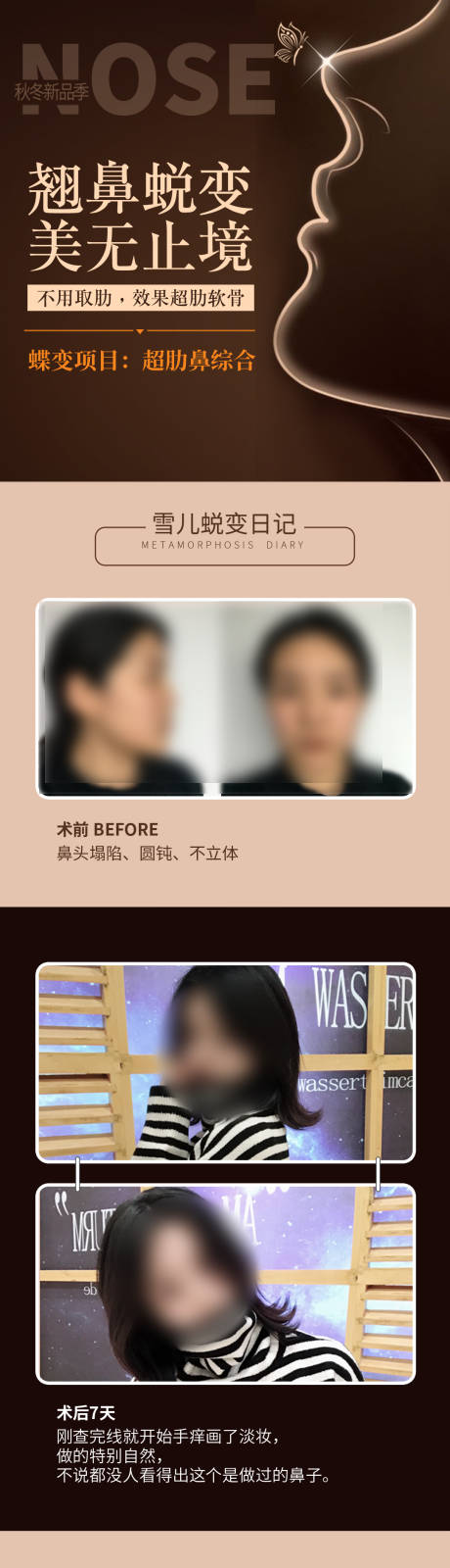 源文件下載【享設計】搜索編號：95350018616807000【大氣超肋隆鼻案例長圖海報】