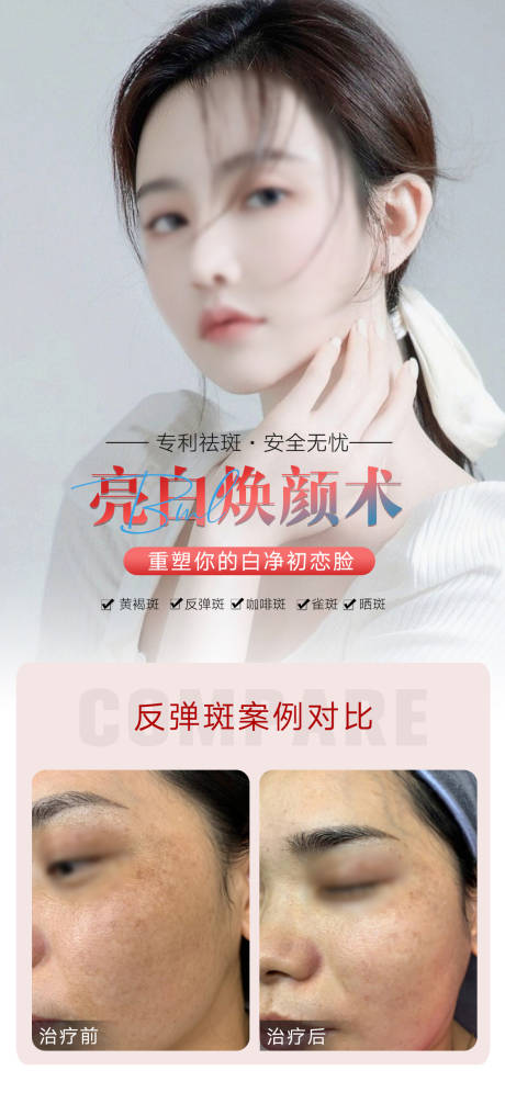 源文件下載【祛斑海報(bào)】編號(hào)：28080018783281874