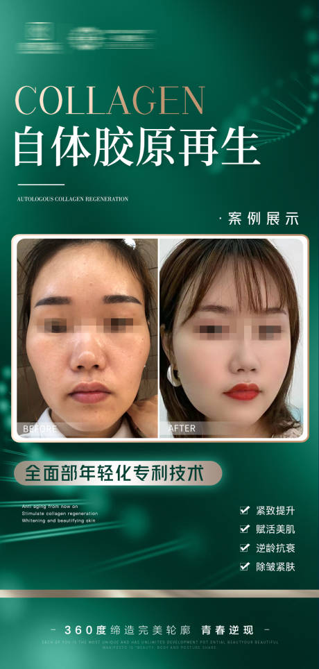 源文件下載【享設計】搜索編號：24020018704491815【醫美案例海報】