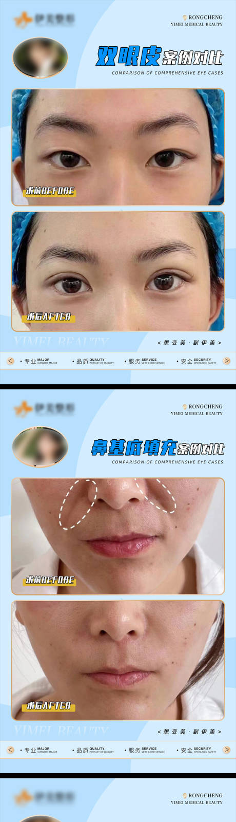 源文件下載【醫美案例對比海報】編號：50740018984982845
