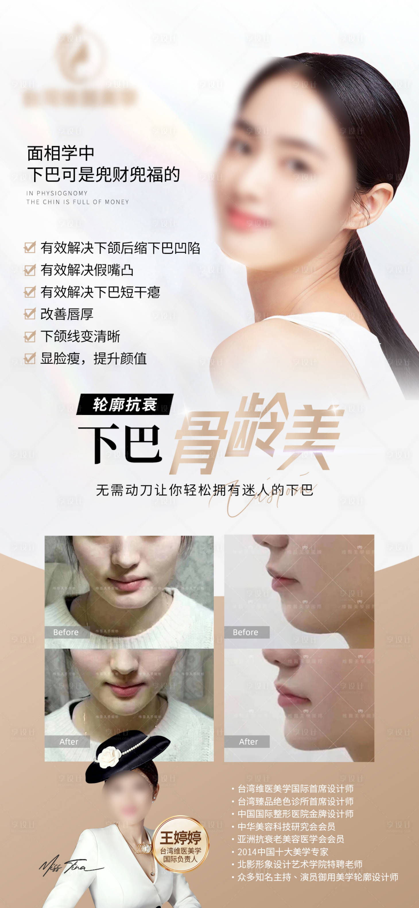 源文件下載【享設計】搜索編號：39250018334455299【醫美輪廓固定骨相美朋友圈海報】