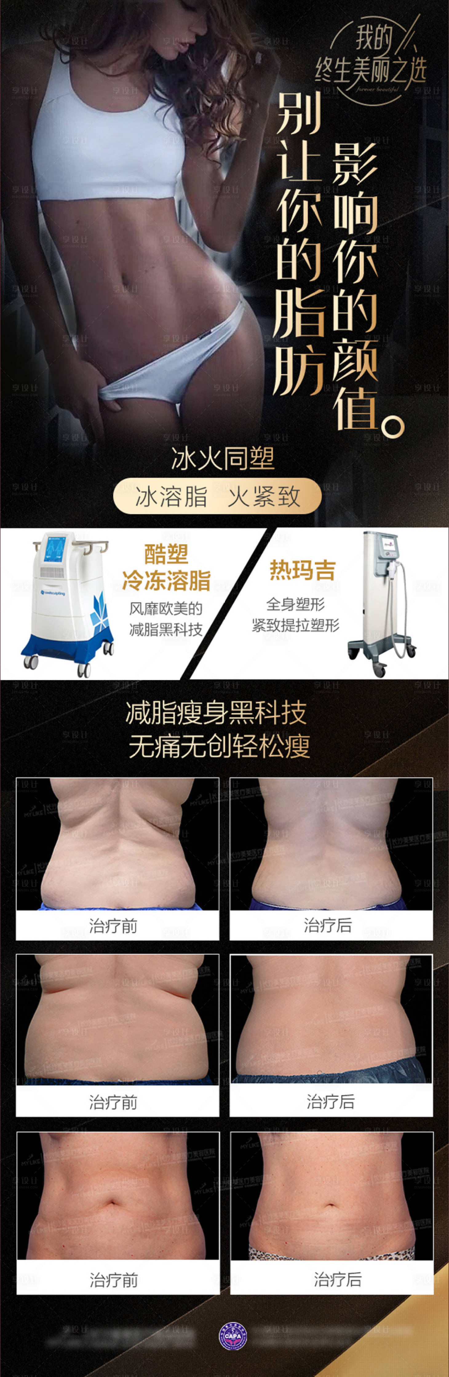 源文件下载【医美酷塑宣传海报】编号：41110018521508827