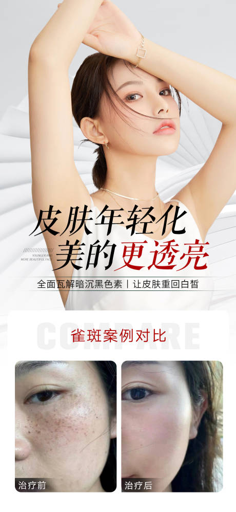 源文件下载【享设计】搜索编号：89330018678036007【医美祛斑海报】