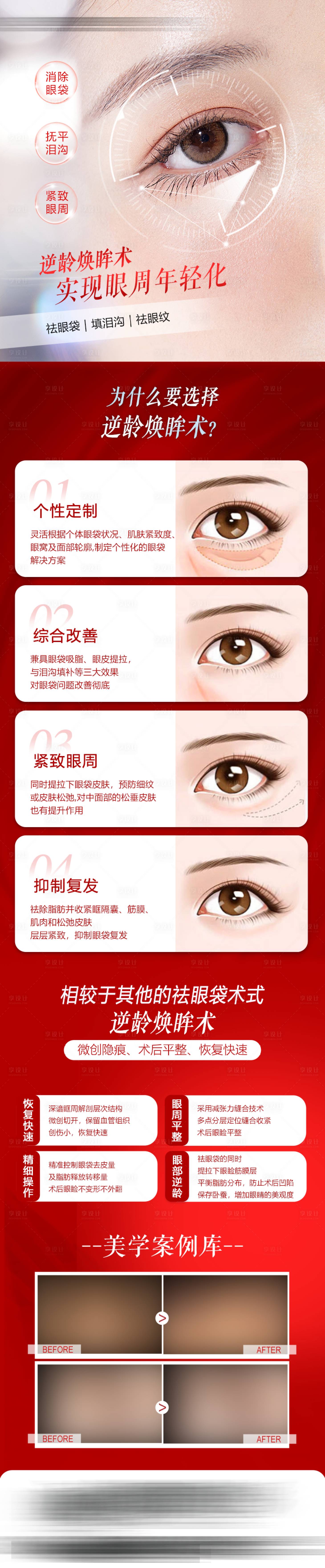 源文件下載【享設(shè)計】搜索編號：32070018926203621【祛眼袋長圖】