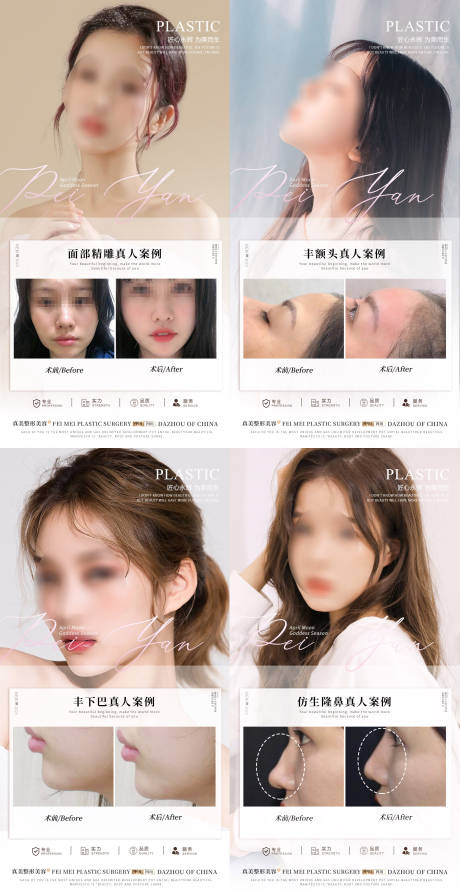 源文件下载【整形案例】编号：35450018547864636