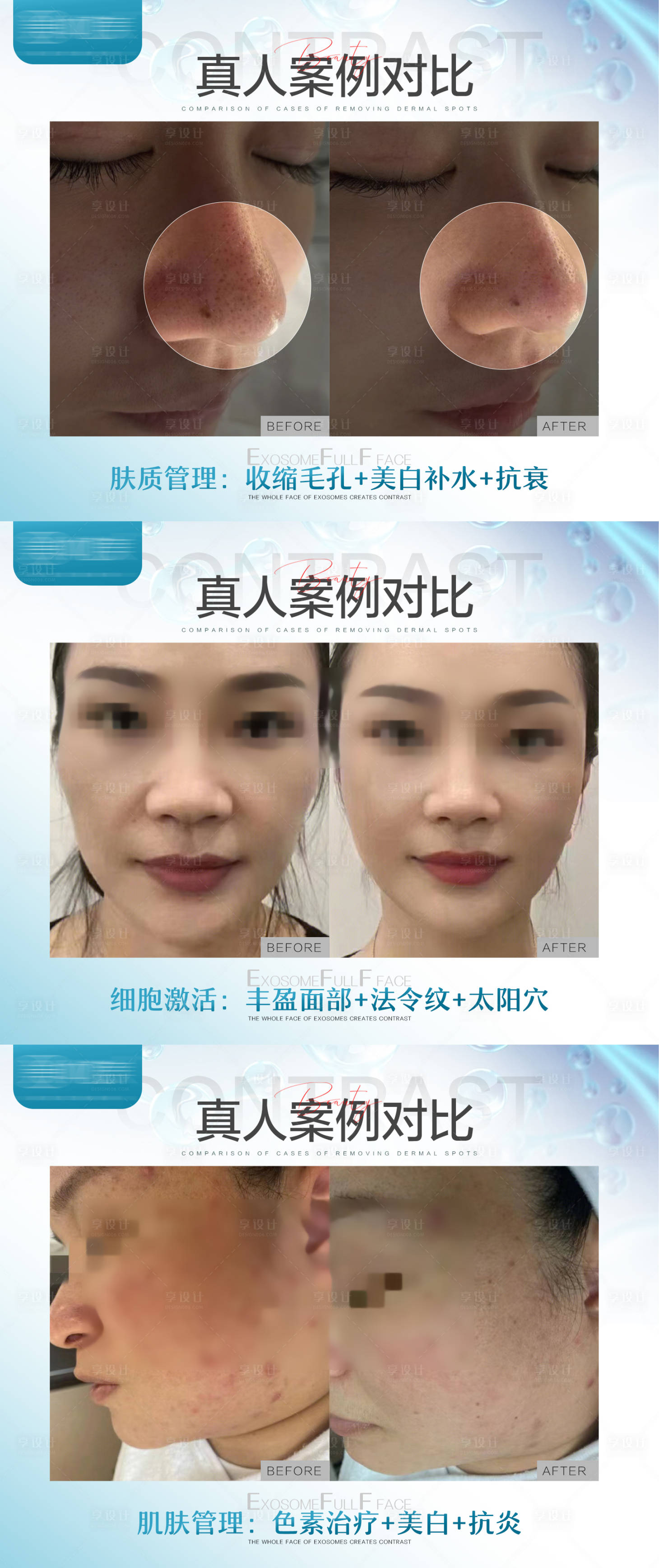 源文件下载【享设计】搜索编号：94320018852446086【医美案例海报】