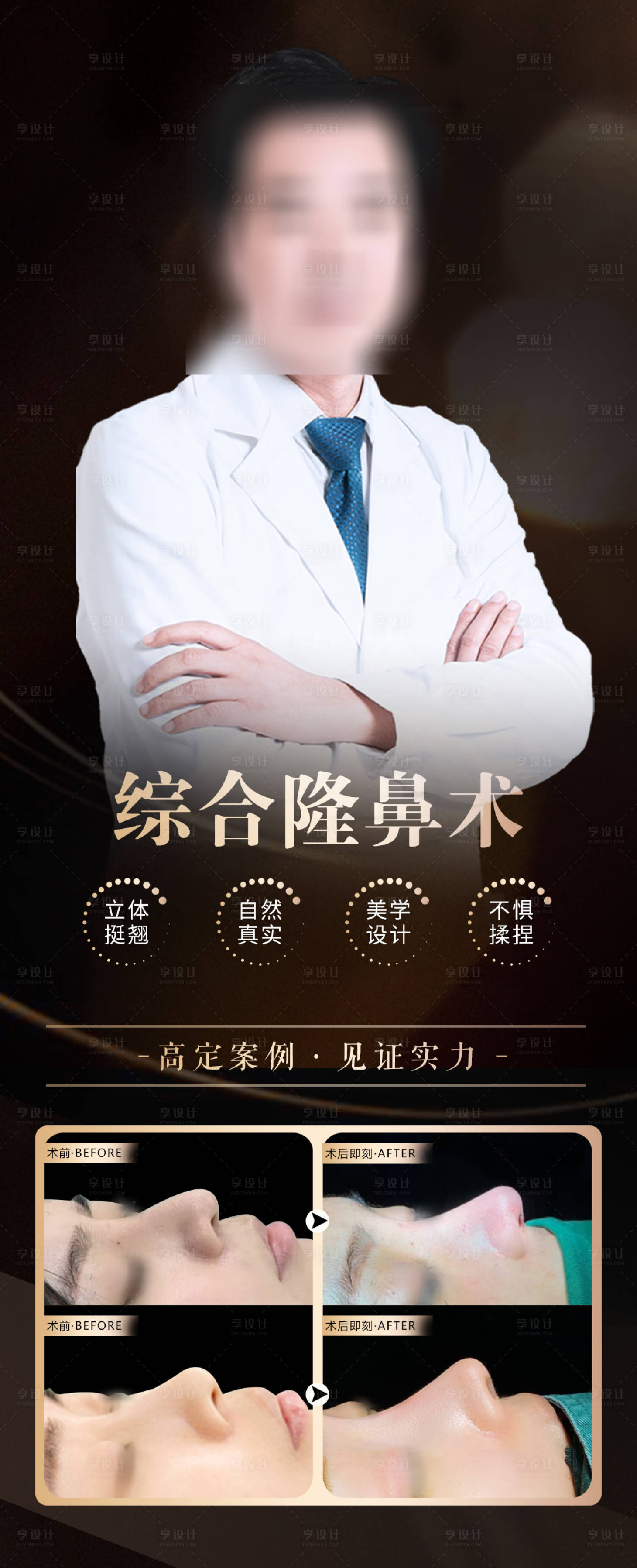源文件下載【享設計】搜索編號：41890018703027148【醫(yī)美院長隆鼻案例海報】