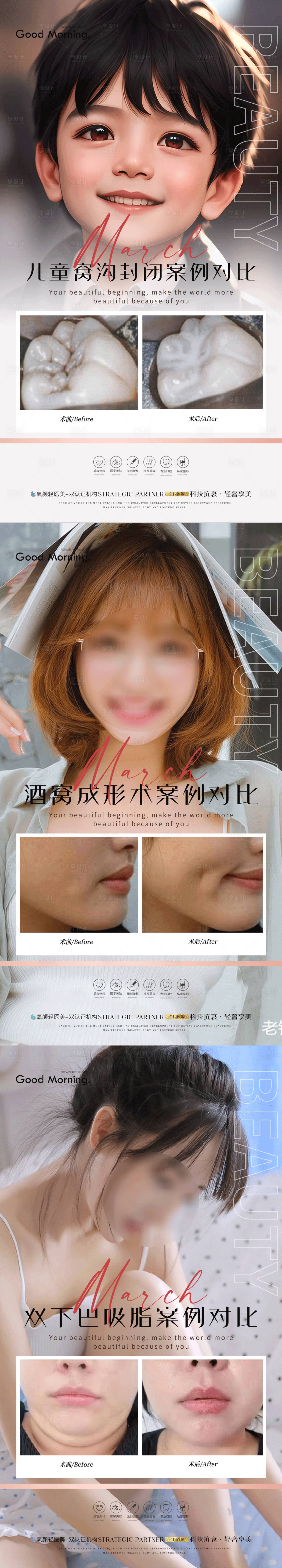 源文件下載【享設計】搜索編號：90390018949874822【醫美整形口腔案例海報】