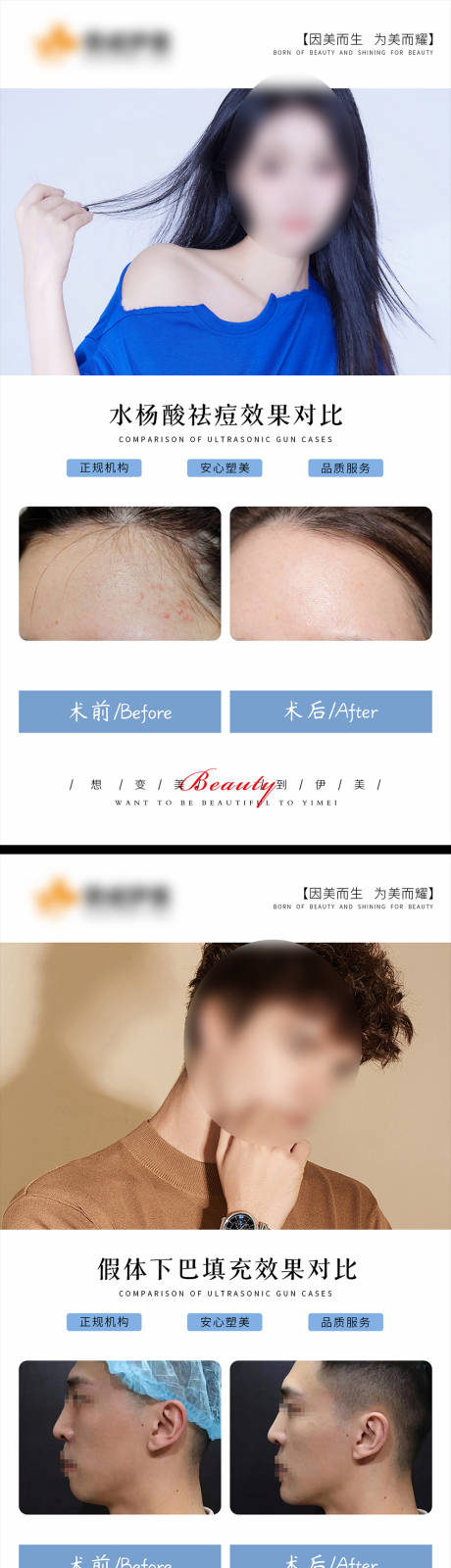 源文件下载【享设计】搜索编号：12650018973998254【医美案例对比系列海报】
