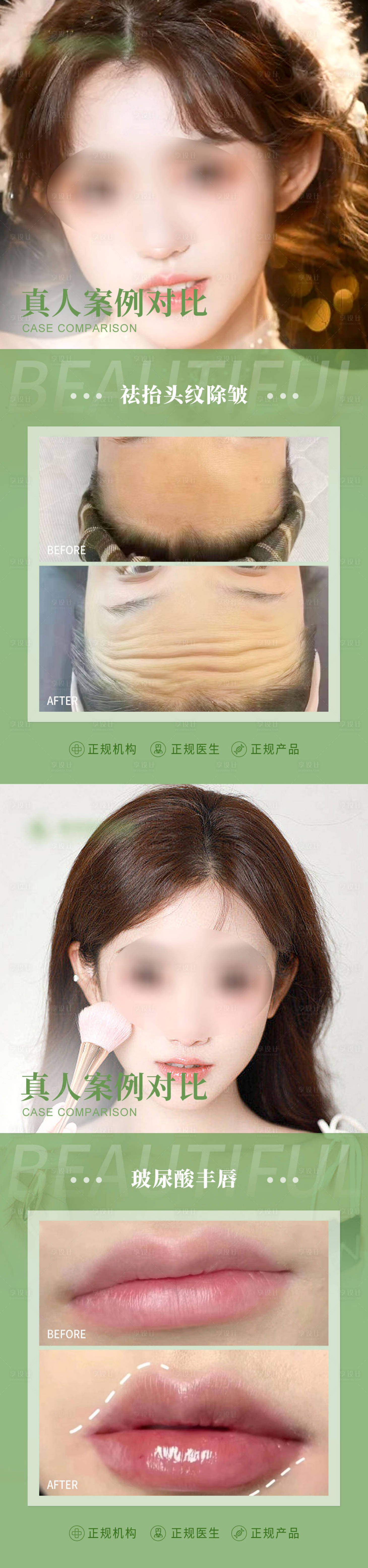 源文件下載【享設(shè)計】搜索編號：47930018783534856【整形案例對比圖海報】